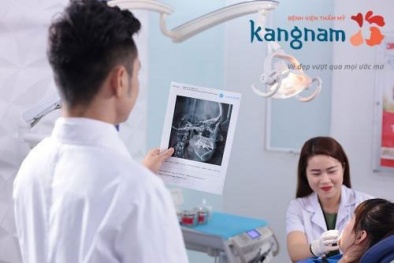 Bọc răng sứ Perfect Smile - Kiến tạo nụ cười hoàn hảo
