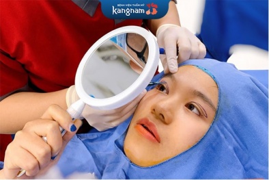 Cắt mí mắt đẹp tự nhiên và những điều cần biết
