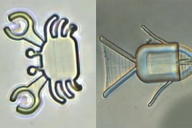 Robot tí hon 'vận chuyển' thuốc trong cơ thể người để tiêu diệt tế bào ung thư