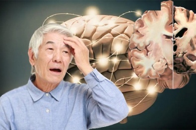 Thuốc Viagra có thể làm giảm nguy cơ mắc bệnh Alzheimer?