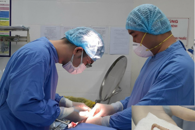 Nhiễm trùng, thủng đầu mũi sau 4 năm nâng mũi