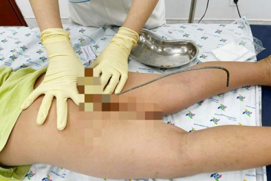 Bé trai gặp nguy hiểm sức khỏe khi làm theo phim ảnh trên mạng