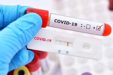 Độ đậm nhạt trên vạch kit test nhanh không nói lên bệnh nặng hay nhẹ