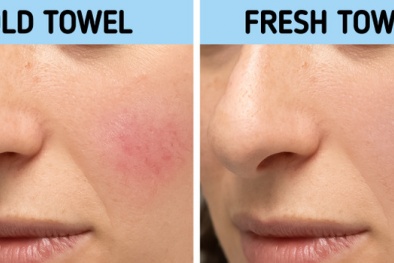 Những vấn đề phải đối mặt nếu sử dụng khăn mặt bẩn