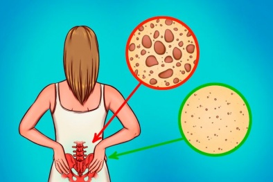 7 lợi ích cho sức khỏe khi ăn hành tây thường xuyên