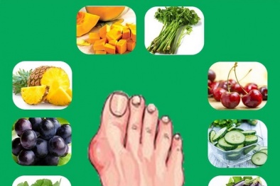 Người mắc bệnh gout nên tránh ăn món gì?