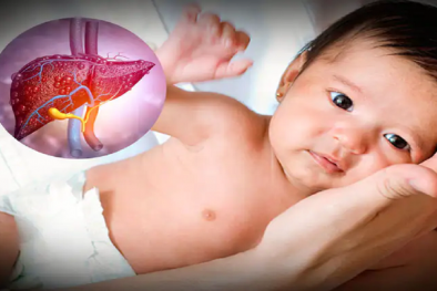 Sở Y tế TP.HCM khuyến cáo về dịch viêm gan cấp gây tử vong ở trẻ em