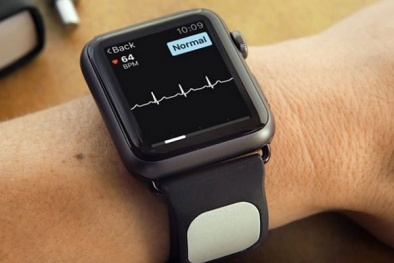 Đồng hồ thông minh có thể phát hiện sớm tình trạng suy tim