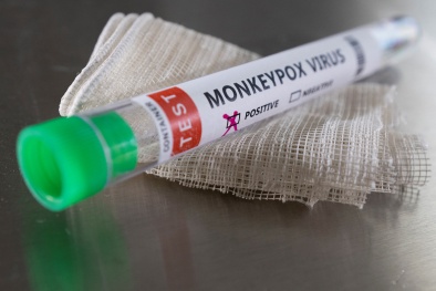 Khuyến cáo 6 biện pháp phòng bệnh đậu mùa khỉ