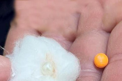 Cảnh báo tình trạng trẻ nhỏ hóc hạt vòng làm từ nhựa