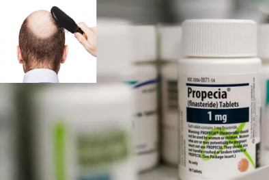 Thuốc trị hói đầu Propecia có thể gây rối loạn tình dục, tự tử ở nam giới