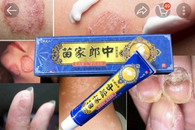 Cảnh báo kem bôi da 'trị bách bệnh' không rõ nguồn gốc trên mạng xã hội