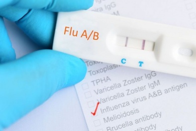 Chuyên gia khuyến cáo người tiêu dùng về mua và sử dụng kit test cúm A