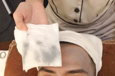 Hút chì thải độc cho da: 'Chiêu trò' câu khách!