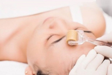 Bác sĩ cảnh báo nhiều hậu quả nếu lăn kim chữa mụn trên mặt sai cách