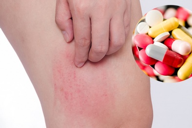 Cảnh báo tình trạng sốc phản vệ do tự dùng thuốc điều trị 
