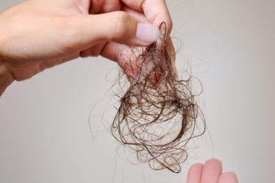 Lưu ý khi sử dụng thuốc trị rụng tóc minoxidil 