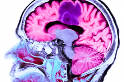 Nghiên cứu ra loại vaccine đầu tiên có thể điều trị u não ác tính