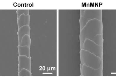 Thử nghiệm thành công miếng dán vi kim mới giúp phục hồi tóc rụng