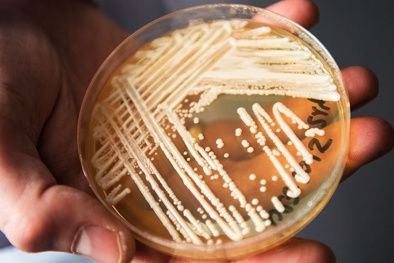 Mối đe dọa toàn cầu từ các loại nấm kháng thuốc