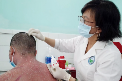 Biến chứng nặng do tự ý sử dụng thuốc điều trị vảy nến trên mạng