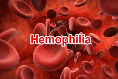 Liệu pháp gene đầu tiên được phê duyệt giúp chữa trị bệnh rối loạn đông máu