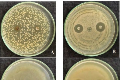 Sáng chế màng trị bỏng làm nhanh liền vết thương