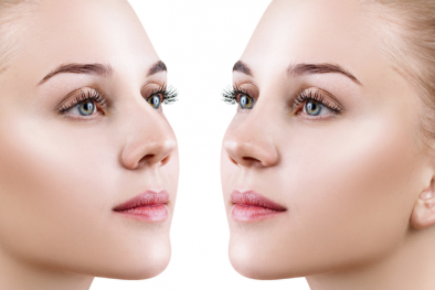 Những hậu quả của nâng mũi khi về già