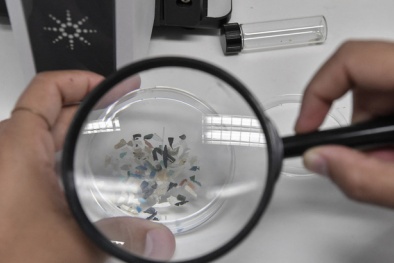 Cảnh báo: Phát hiện hạt vi nhựa trong mô tĩnh mạch người