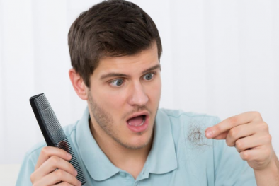 Sử dụng nhiều đồ ngọt có thể gây rụng tóc ở nam giới trẻ tuổi