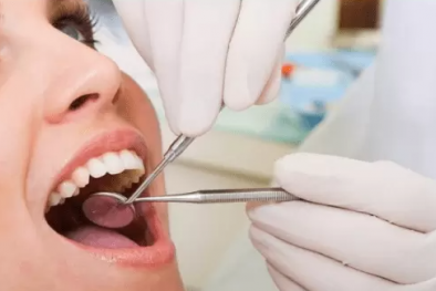 Nguy cơ 'gặp họa' khi sử dụng thuốc tẩy trắng răng 