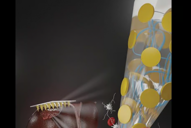 Phát triển miếng dán vi kim cầm máu nhanh hơn băng thông thường