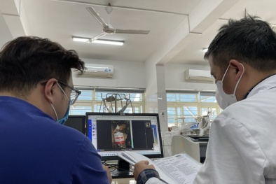 Uống quá nhiều rượu gây nhồi máu não, tắc thận dẫn tới suy thận