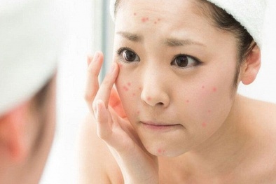 Những chất gây dị ứng cho da phổ biến trong các sản phẩm mỹ phẩm