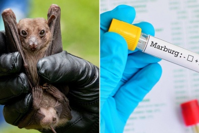 Cảnh báo virus Marburg: WHO họp khẩn và có khả năng lây sang Việt Nam 