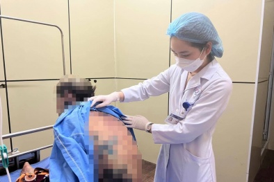  Nam thanh niên bị dị ứng nhiễm độc nặng do tự ý mua thuốc sử dụng