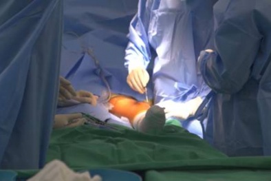 Vinmec thực hiện ca thay khớp tăng trưởng đầu tiên tại Việt Nam cho bệnh nhi ung thư xương