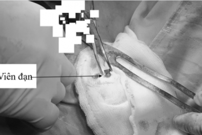 Cảnh báo: Hiểm họa từ súng hơi 