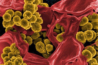 Sở Y tế Hà Nội công bố nguyên nhân khiến 72 học sinh trường Tiểu học Kim Giang bị ngộ độc