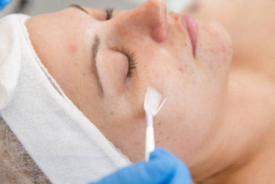 Thay da hóa học đang lan truyền trên TikTok có thể gây rối loạn nhịp tim 