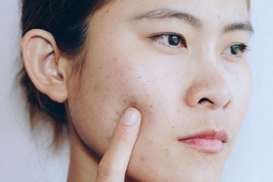 Dùng sản phẩm treatment đặc trị theo tư vấn trên mạng, nhiều người nhận 'trái đắng'
