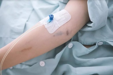 Nhiều người phải cấp cứu do phản vệ khi tự truyền dịch tại nhà