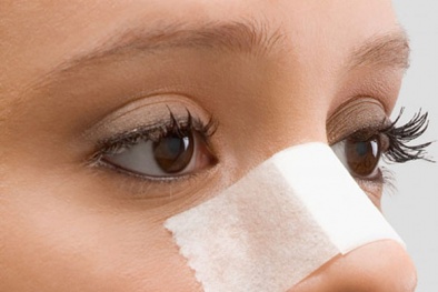 Những biến chứng nguy hiểm có thể xảy ra sau khi thực hiện phẫu thuật nâng mũi