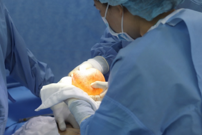 Nguy cơ gây biến chứng thông khe khi đặt túi ngực quá lớn