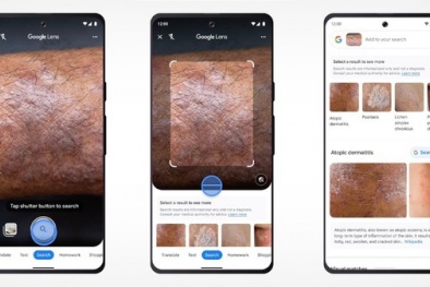 Công cụ chẩn đoán sức khỏe làn da qua ảnh chụp