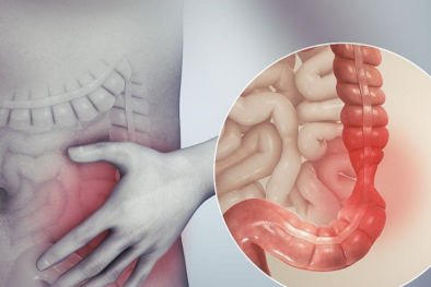 Sử dụng kháng sinh thường xuyên có nguy cơ dẫn tới viêm đại tràng giả mạc