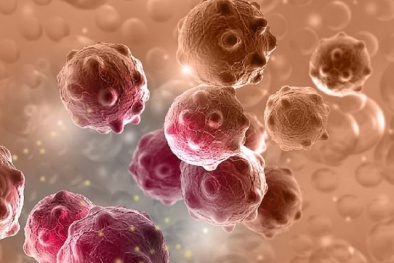 Các nhà khoa học Mỹ tạo ra loại thuốc mới có thể tiêu diệt 70 loại tế bào ung thư trong cơ thể
