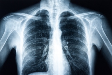 Tiêu chuẩn đảm bảo chất lượng chụp tia X-quang năng lượng cao