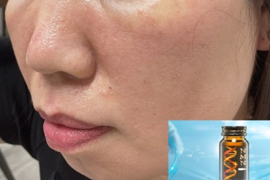 Hoạt chất NMN 'đảo ngược lão hóa' chưa có bằng chứng khoa học cụ thể, tránh lạm dụng