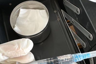 Cảnh báo: Hoại tử mí mắt do tiêm filler bằng gel oxy già tẩy trắng răng